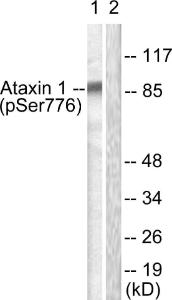 Western blot analysis of lysates from HepG2 cells treated with Adriamycin 0.5 µM 5 h using Anti-Ataxin 1 (phospho Ser776) Antibody. The right hand lane represents a negative control, where the Antibody is blocked by the immunising peptide