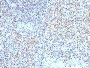 Immunohistochemical analysis of formalin-fixed, paraffin-embedded human spleen using Anti-CD40L Antibody [CD40LG/2763]