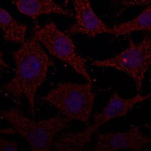 Anti-Cathepsin D Goat Polyclonal Antibody