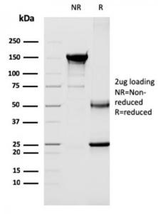 SDS-PAGE analysis of Anti-CD40L Antibody [CD40LG/2763] under non-reduced and reduced conditions; showing intact IgG and intact heavy and light chains, respectively. SDS-PAGE analysis confirms the integrity and purity of the antibody