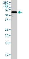 Anti-PAPSS2 Mouse Monoclonal Antibody [clone: 2A8]