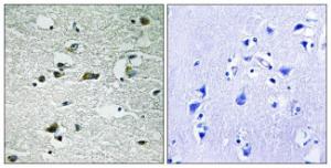 Immunohistochemical analysis of paraffin-embedded human brain using Anti-CSNK1G1 (phospho Tyr263) Antibody The right hand panel represents a negative control, where the antibody was pre-incubated with the immunising peptide