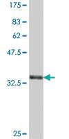 Anti-PPT2 Mouse Polyclonal Antibody