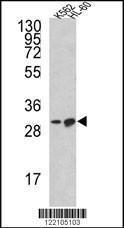 Anti-BCL2L11 Rabbit Polyclonal Antibody (Biotin)