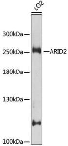 Western blot analysis of extracts of LO2 cells, using Anti-ARID2 Antibody (A10469) at 1:1,000 dilution. The secondary antibody was Goat Anti-Rabbit IgG H&L Antibody (HRP) at 1:10,000 dilution.