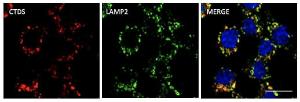 Anti-Cathepsin D Goat Polyclonal Antibody