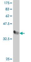 Anti-F9 Mouse Polyclonal Antibody