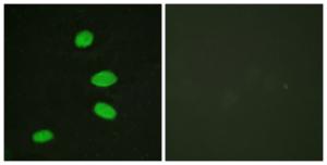 Immunofluorescence analysis of HeLa cells using Anti-RBL2 Antibody The right hand panel represents a negative control, where the antibody was pre-incubated with the immunising peptide