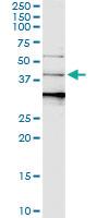 Anti-SERPINB3 Polyclonal Antibody Pair