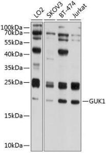 Western blot analysis of extracts of various cell lines, using Anti-Guanylate kinase Antibody (A10484) at 1:1,000 dilution. The secondary antibody was Goat Anti-Rabbit IgG H&L Antibody (HRP) at 1:10,000 dilution.