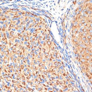 Immunohistochemistry analysis of paraffin-embedded rat ovary using Anti-gamma Adaptin Antibody [ARC2440] (A308552) at a dilution of 1:100 (40X lens). Perform microwave antigen retrieval with 10 mM Tris/EDTA buffer pH 9.0 before commencing with IHC staining protocol