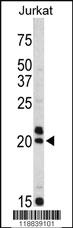 Anti-VIP Rabbit Polyclonal Antibody