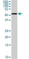 Anti-PAPSS2 Mouse Monoclonal Antibody [clone: 2A8]