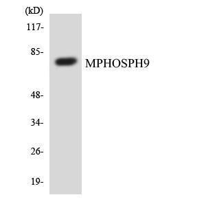 Western blot analysis of the lysates from COLO205 cells using Anti-MPHOSPH9 Antibody