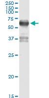 Anti-FSD1 Rabbit Polyclonal Antibody