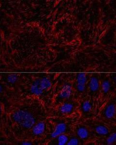 Confocal immunofluorescence analysis of U-2 OS cells using Anti-MSF Antibody (A10485) at a dilution of 1:100. DAPI was used to stain the cell nuclei (blue)