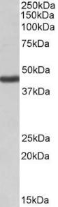 Anti-KCNJ1 Antibody (A82533) (1 µg/ml) staining of Human Kidney lysate (35 µg protein in RIPA buffer). Primary incubation was 1 hour. Detected by chemilu minescence