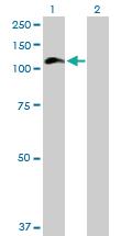 Anti-HIP1 Mouse Polyclonal Antibody