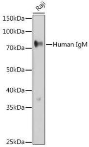 Anti-Human IgM Rabbit Polyclonal Antibody