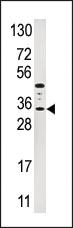 Anti-IGFBP3 Rabbit Polyclonal Antibody