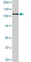 Anti-HIP1 Mouse Polyclonal Antibody