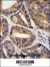 Anti-RNF215 Rabbit Polyclonal Antibody (Biotin)