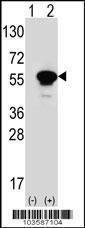 Anti-PACSIN1 Rabbit Polyclonal Antibody (AP (Alkaline Phosphatase))