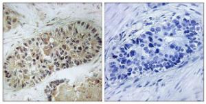 Antibody anti-artemis phospho SER516