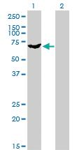 Anti-PAPSS2 Mouse Monoclonal Antibody [clone: 2A8]