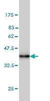 Anti-STX5 Mouse Monoclonal Antibody [clone: 5A6]