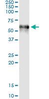 Anti-F9 Antibody Pair