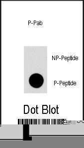 Anti-MAP4K1 Rabbit Polyclonal Antibody (PE (Phycoerythrin))