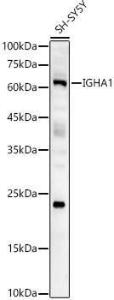 Western blot analysis of SH-SY5Y, using Anti-Human IgA Antibody (A10496) at 1:2000 dilution