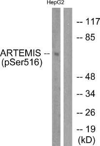 Antibody anti-artemis phospho SER516