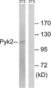 Western blot analysis of lysates from NIH/3T3 cells using Anti-PYK2 Antibody. The right hand lane represents a negative control, where the antibody is blocked by the immunising peptide.