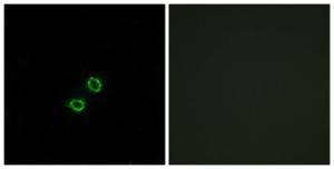 Anti-KIR2DL5B Rabbit Polyclonal Antibody