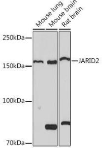 Western blot analysis of extracts of various cell lines, using Anti-Jarid2 Antibody [ARC1658] (A305856) at 1:1,000 dilution