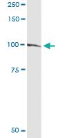 Anti-RASA1 Polyclonal Antibody Pair