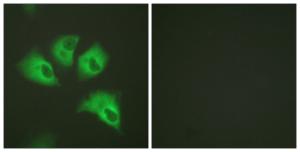 Immunofluorescence analysis of HeLa cells using Anti-Kir5.1 (phospho Ser417) Antibody. The right hand panel represents a negative control, where the antibody was pre-incubated with the immunising peptide