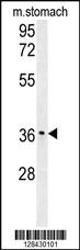 Anti-IGFBP3 Rabbit Polyclonal Antibody