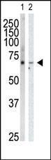 Anti-GRK6 Rabbit Polyclonal Antibody (FITC (Fluorescein))