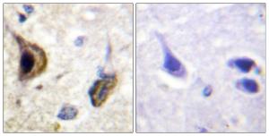 Immunohistochemical analysis of paraffin-embedded human brain using Anti-Kir5.1 (phospho Ser417) Antibody. The right hand panel represents a negative control, where the antibody was pre-incubated with the immunising peptide