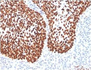 Immunohistochemical analysis of formalin-fixed, paraffin-embedded human cervix using Anti-SOX2 Antibody [SOX2/4267R] at 2 µg/ml in PBS for 30 minutes at room temperature