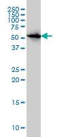 Anti-CAP1 Mouse Monoclonal Antibody [clone: 4A2]