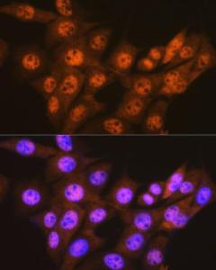 Immunofluorescence analysis of NIH-3T3 cells using Anti-Proteasome 20S C2 / HC2 Antibody [ARC0780] (A308553) at a dilution of 1:100 (40x lens). DAPI was used to stain the cell nuclei (blue)