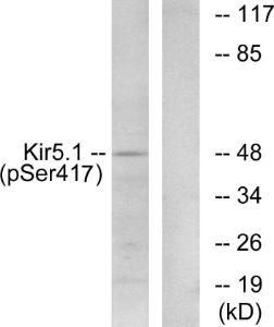 Western blot analysis of lysates from RAW264.7 cells treated with forskolin 40nM 30' using Anti-Kir5.1 (phospho Ser417) Antibody. The right hand lane represents a negative control, where the antibody is blocked by the immunising peptide