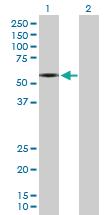 Anti-SLC1A2 Rabbit Polyclonal Antibody