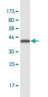 Anti-DSG4 Mouse Monoclonal Antibody [clone: 6E7]