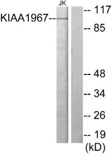 Anti-KIAA1967 Rabbit Polyclonal Antibody