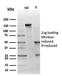 SDS-PAGE analysis of Anti-GTF2H2C Antibody [PCRP-GTF2H2C-2C9] under non-reduced and reduced conditions; showing intact IgG and intact heavy and light chains, respectively. SDS-PAGE analysis confirms the integrity and purity of the antibody